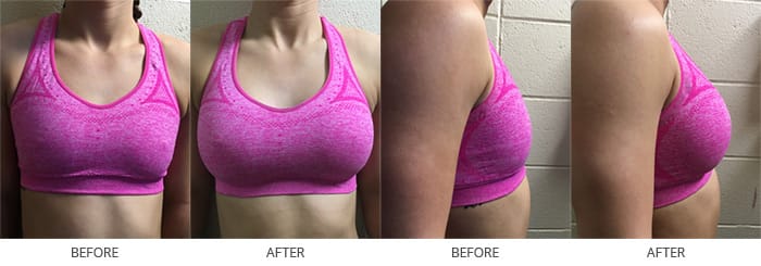 Sheila's before and after photos