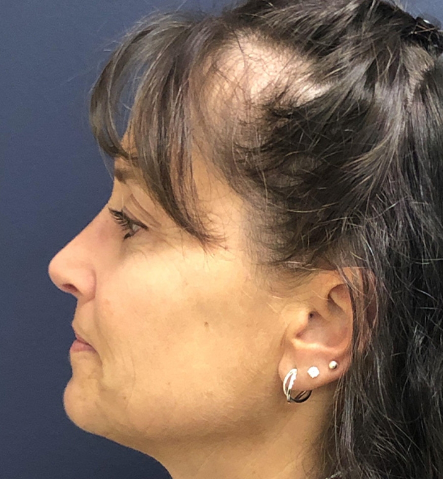 After