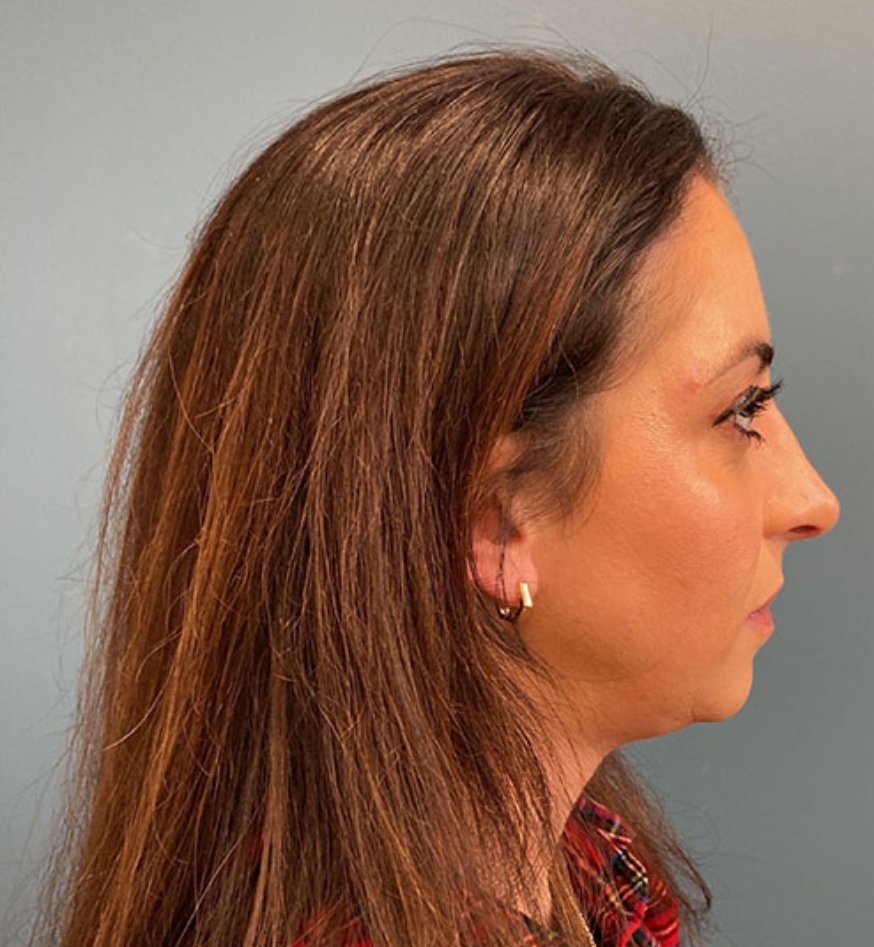After