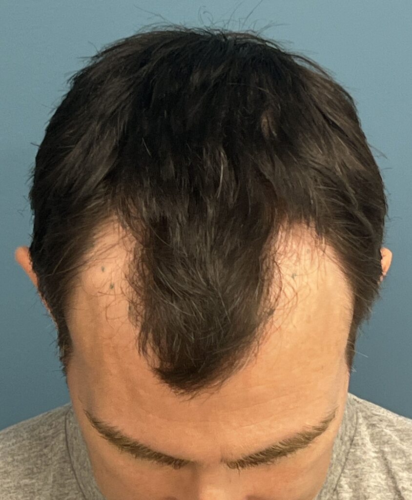 Before