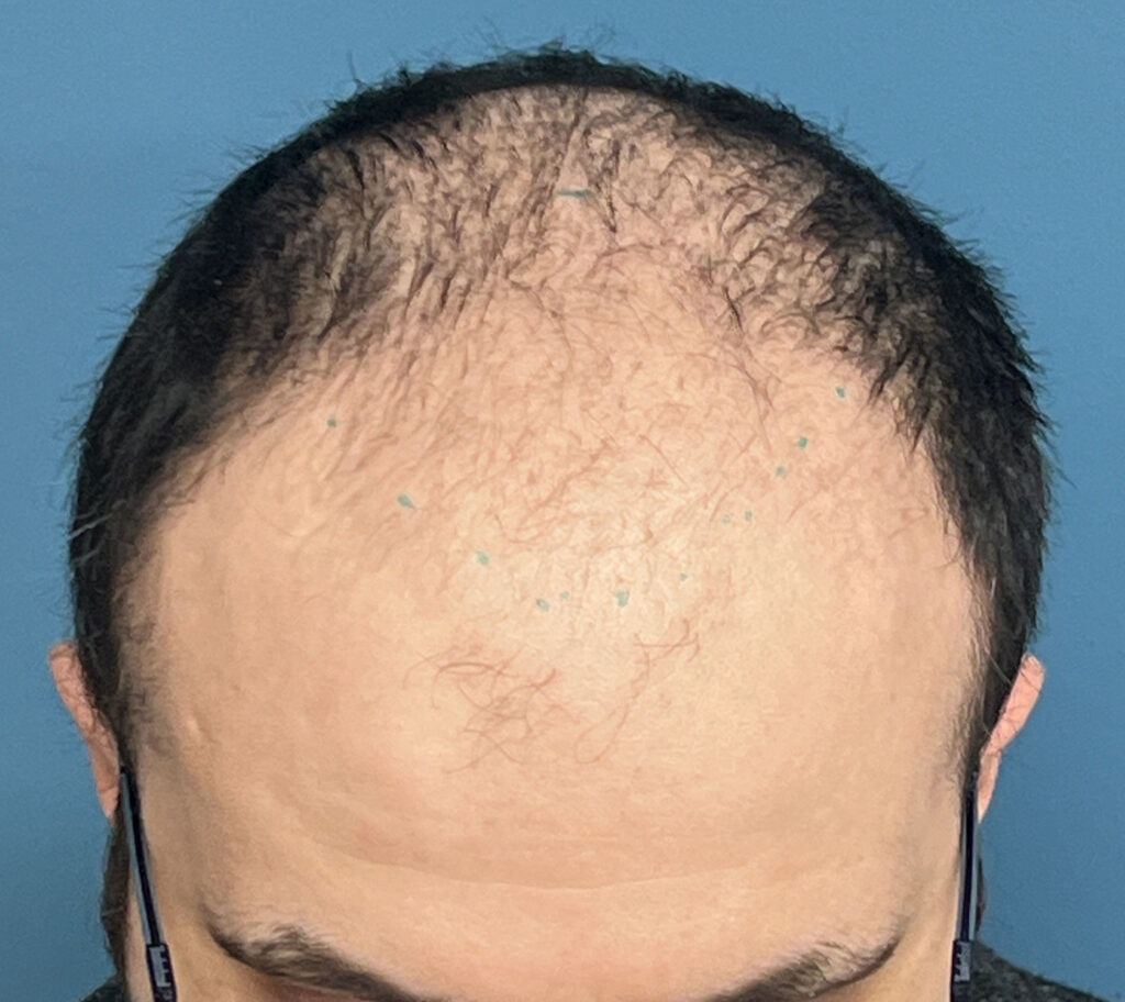 Before