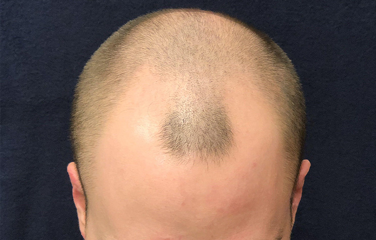 Before